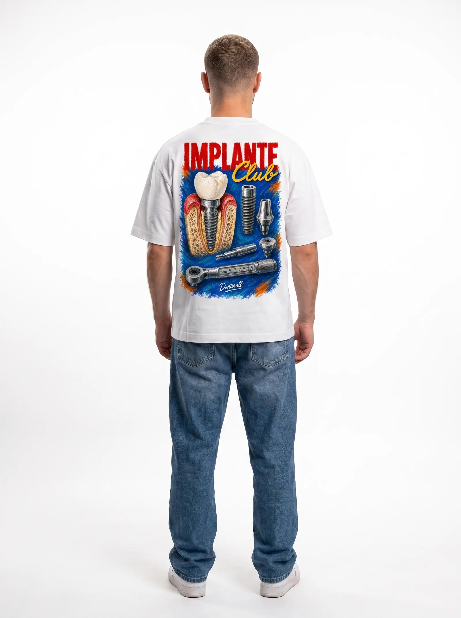 Implante Club · costas